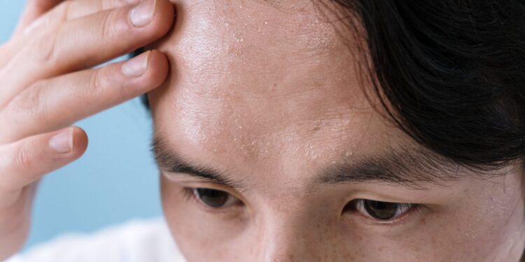 Everything You Need To Know About Hair Diseases - The Disability Doc